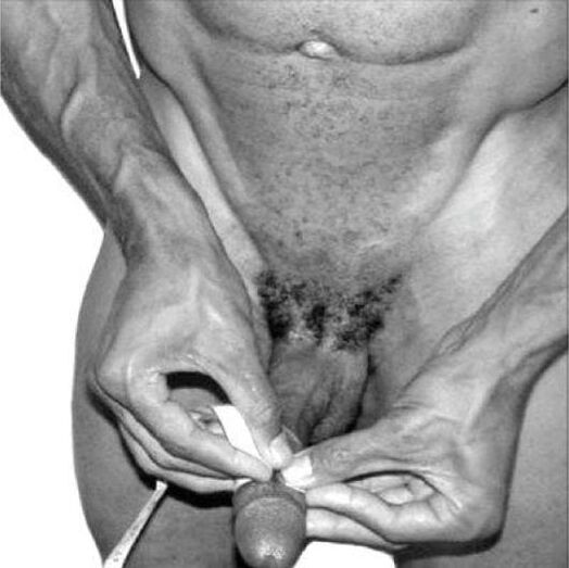 misurazione del pene prima dell'ingrandimento